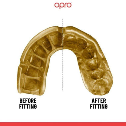 OPRO Gold Ultra Fit Mouthguard - Adult - 10 Years + - BLUE